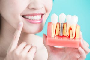 healthy dental concept