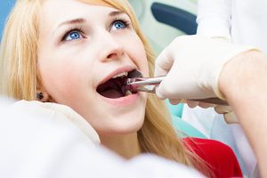 Teeth Extraction for Improved Oral Health and Wellness 