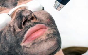 Radiant Skin with Singapore's Carbon Laser Peel Revolution
