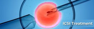 ICSI in Fertility Treatment